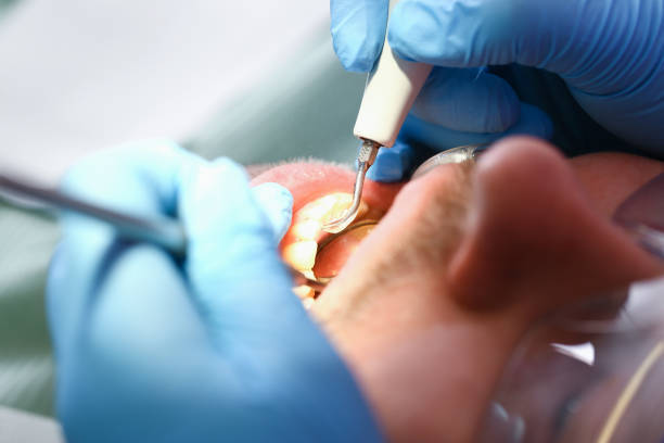 Best Broken or Chipped Tooth Repair in Robbinsdale, MN