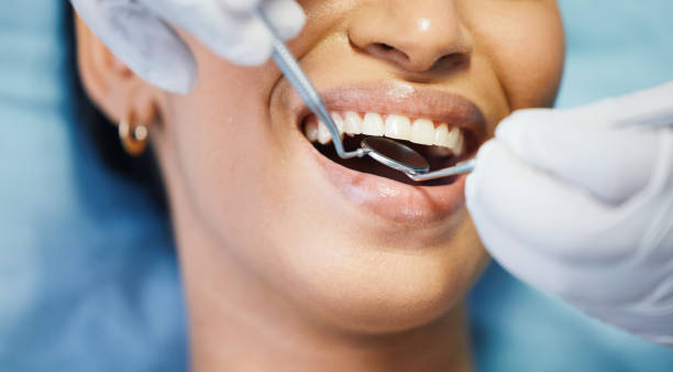 Best Dental Abscess Treatment in Robbinsdale, MN